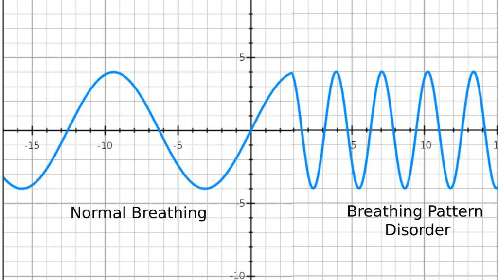 Dysfunctional breathing - What is it and How can I manage it?