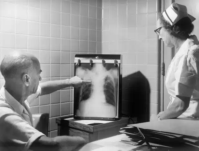 Doctor and nurse looking at interstitial lung disease chest x-ray